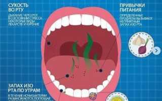 Запах изо рта