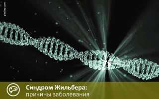 Синдром Жильбера: что это такое простыми словами