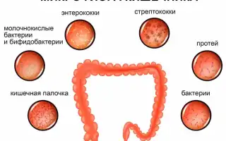 Дезбактериоз