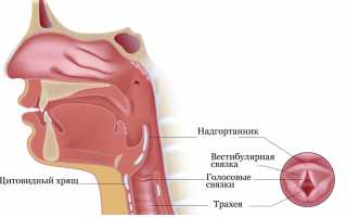 Рак гортани