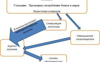 Ацетонемический синдром