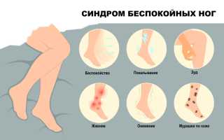 Синдром беспокойных ног