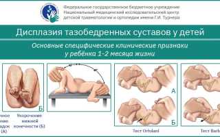 Дисплазия тазобедренного сустава (ДТС)