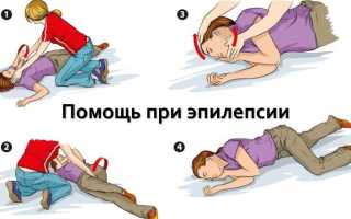 Эпилепсия