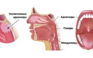 Аденойды