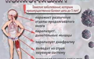 Полиомиелит