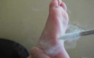 Криотерапия: что нужно знать о лечении холодом