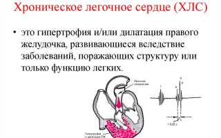 Легочное сердце