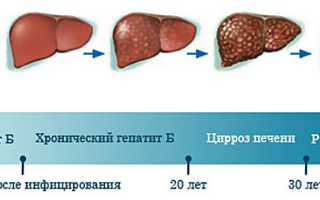 Гепатит B