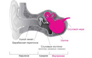 Тугоухость