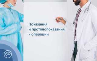 Как подготовиться к операции по удалению желчного пузыря?