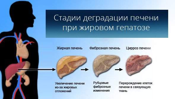 Диета при жировом гепатозе печени: меню на неделю с рецептами
