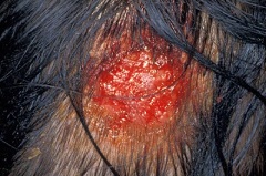 Инфильтративно-нагноительная трихофития