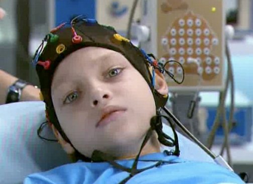 Лечение эпилепсии