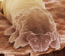 Демодекс - паразит вызывающий демодекоз