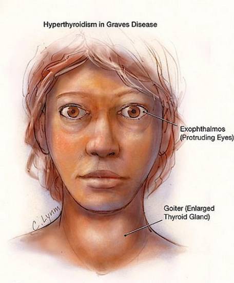 Признаки заболевания