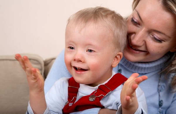 отличие синдрома Дауна и олигофрении