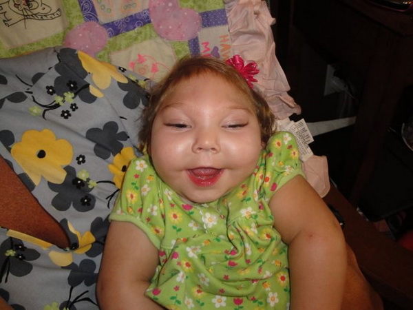 сопутствующие заболевания