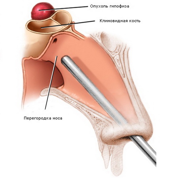 Схема операции