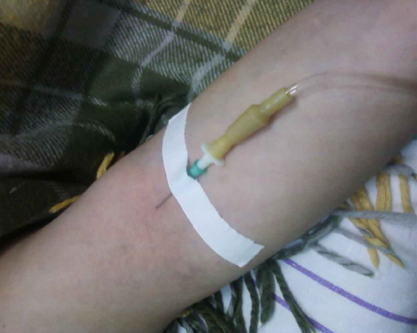 Внутривенное введение иглы